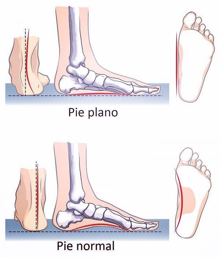 Pie Plano