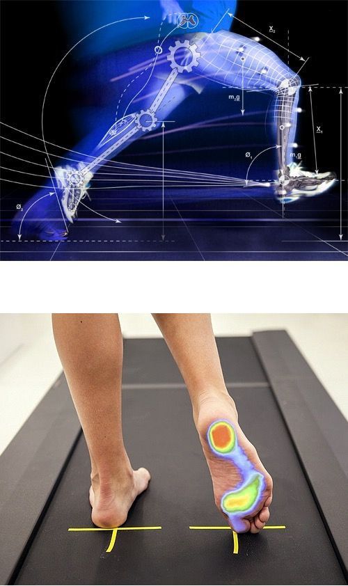 Analisis Biomecanido de la Marcha